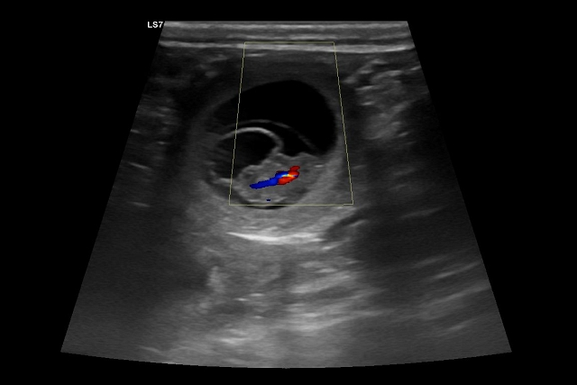 Chara Ultraschall Chara Ultraschall